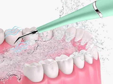 Skaler dentystyczny ultradźwiękowy do czyszczenia zębów usuwanie kamienia Skaler dentystyczny ultradźwiękowy do czyszczenia zębów usuwanie kamienia