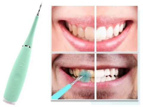 Skaler dentystyczny ultradźwiękowy do czyszczenia zębów usuwanie kamienia Skaler dentystyczny ultradźwiękowy do czyszczenia zębów usuwanie kamienia