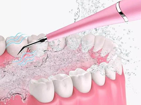 Skaler dentystyczny ultradźwiękowy do czyszczenia zębów usuwanie kamienia Skaler dentystyczny ultradźwiękowy do czyszczenia zębów usuwanie kamienia