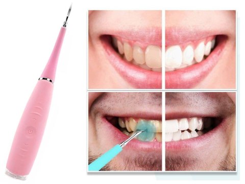 Skaler dentystyczny ultradźwiękowy do czyszczenia zębów usuwanie kamienia Skaler dentystyczny ultradźwiękowy do czyszczenia zębów usuwanie kamienia