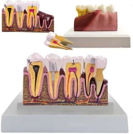 MODEL ANATOMICZNY ZĘBA (16)